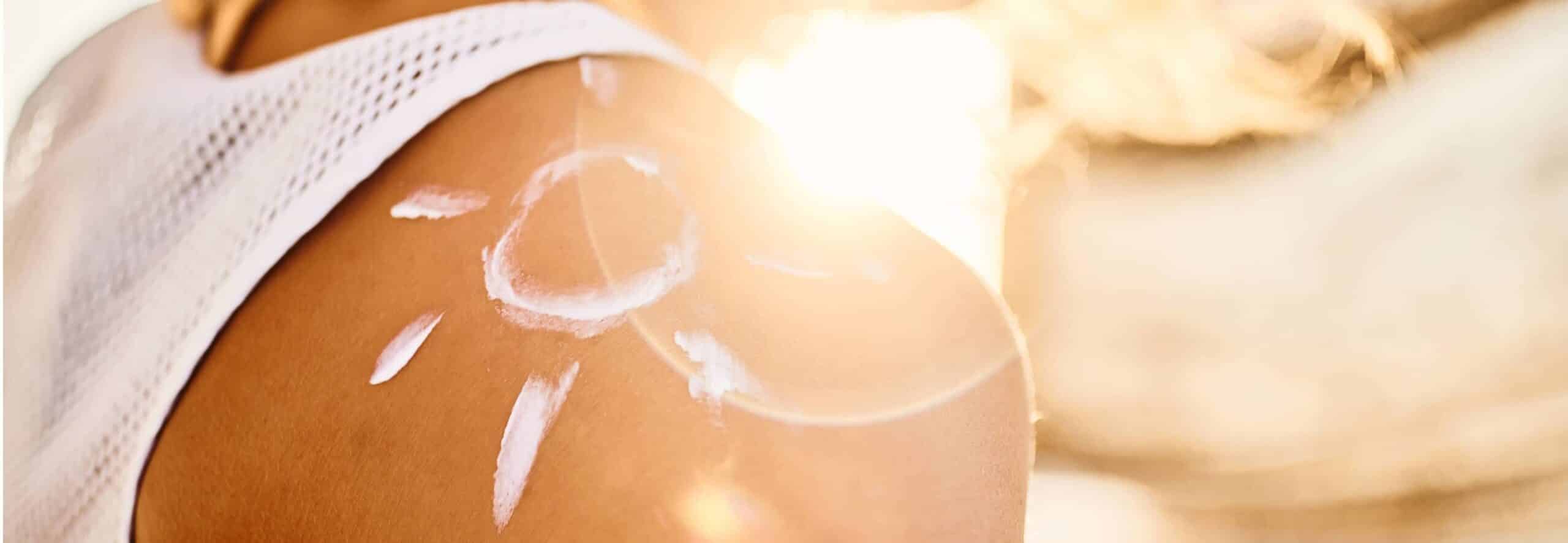 Les impacts du soleil sur la peau : du photovieillissement aux risques de cancer de la peau | Dr Lamquin | Nice